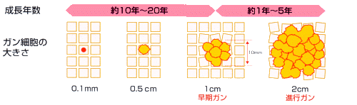 癌は10から20年静かに成長している